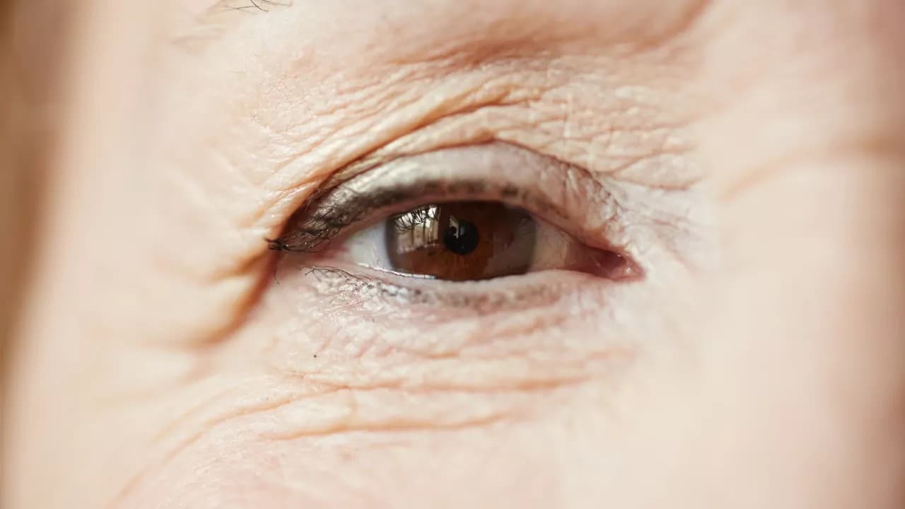 Megereszkedett szemhéjbőr kezelése Budapesten: mik a lehetőségek?